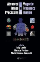 Advance image processing in magnetic resonance imaging /