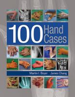 100 hand cases